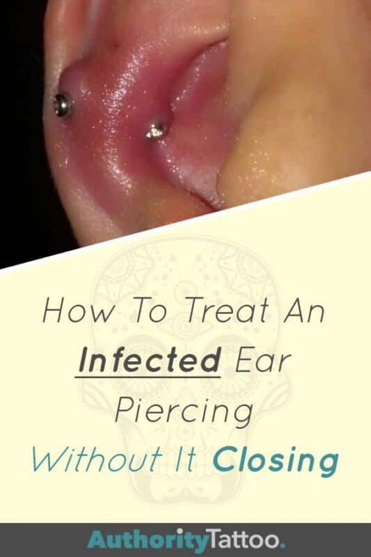 Infection piercing téton solutions