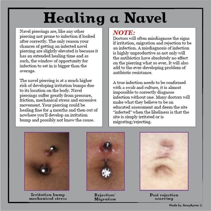 Infection nombril piercing prévention
