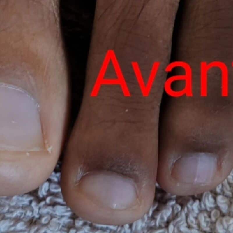 Alternative Dissolvant Vernis