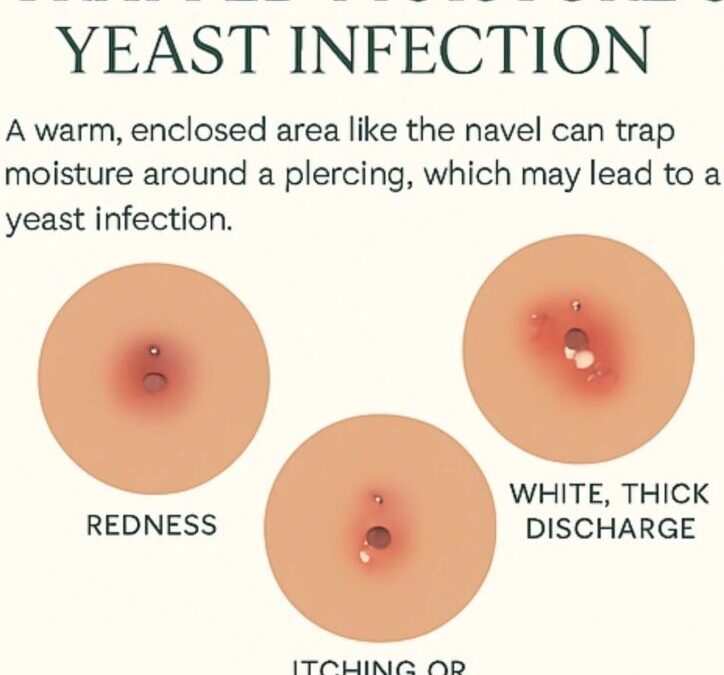 Infection piercing nombril : conseils pour soigner et prévenir