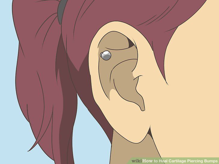 Traitement cicatrices piercing