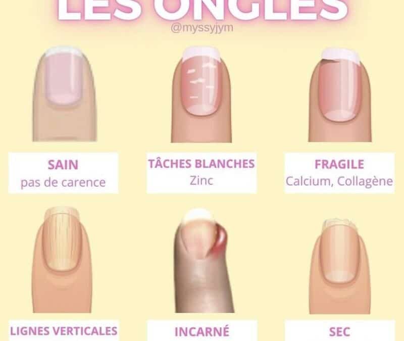 Les risques du dissolvant : sécurité et alternatives sûres à la maison