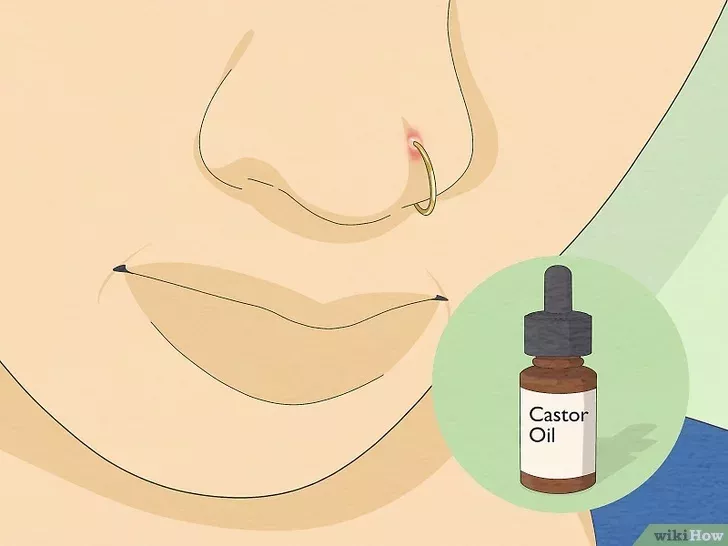 Gérer douleur narine piercing