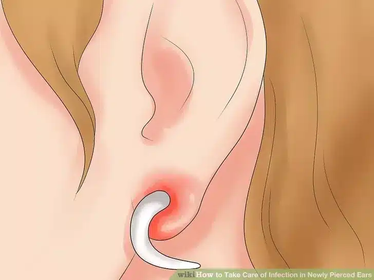 Symptômes infection téton piercing