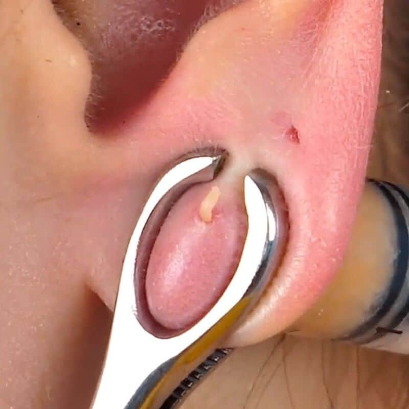 Douleur piercing narine astuces