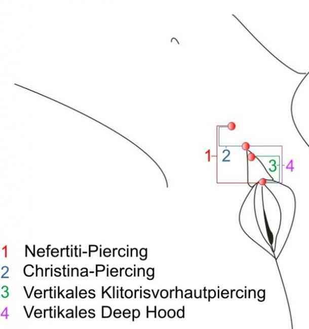 Symptômes infection téton piercing