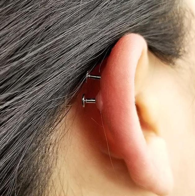 Traitement cicatrices piercing