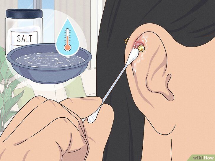 Cicatrisation rapide nombril piercing